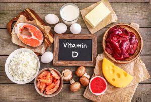 Can Vitamin D Reduce Your Risk for Colon Cancer?